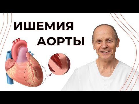 Видео: Ишемия АОРТЫ | Огулов А.Т.