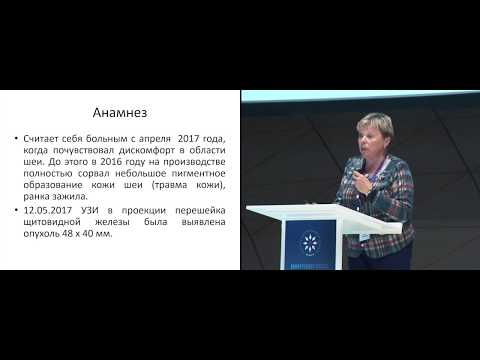 Видео: Меланома. Разбор клинических случаев. Кл. случай 3