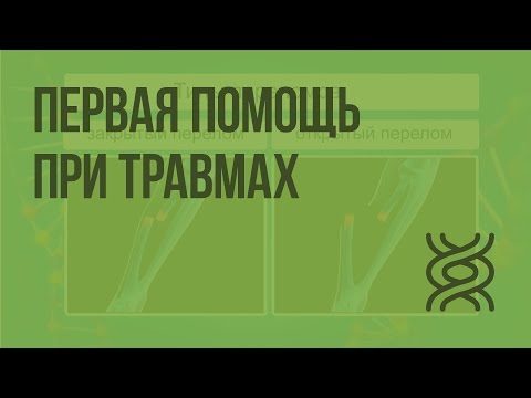 Видео: Первая помощь при травмах: растяжениях связок, вывихах суставов, переломах костей. Видеоурок