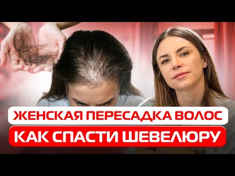 Видео: Как вернуть густые волосы: Всё о женской пересадке волос!