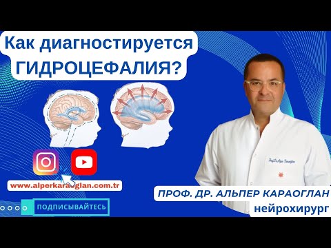 Видео: Как диагностируется ГИДРОЦЕФАЛИЯ? | Профессор доктор Альпер КАРАОГЛАН