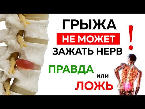 Видео: Межпозвонковая грыжа. Корешковый синдром - правда или ложь? Вся правда о грыжах и лечении
