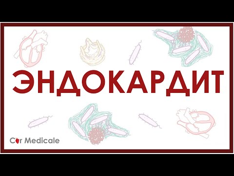 Видео: Эндокардит
