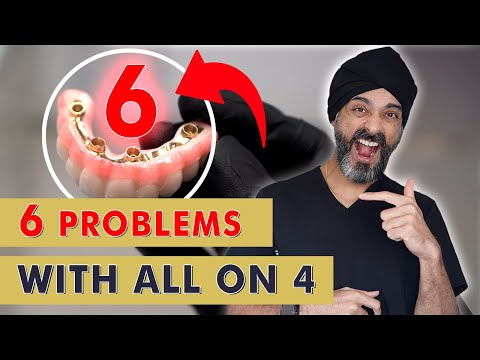 Видео: 6 вещей, которые ваш стоматолог может вам НЕ рассказать о системе «все на 4» или полном наборе зу...
