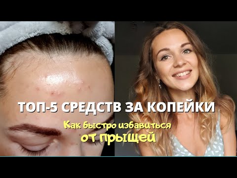 Видео: Топ-5 САМЫХ ДЕЙСТВЕННЫХ бюджетных средств от ПРЫЩЕЙ 🔥 КАК ИЗБАВИТЬСЯ ОТ ПРЫЩЕЙ БЫСТРО