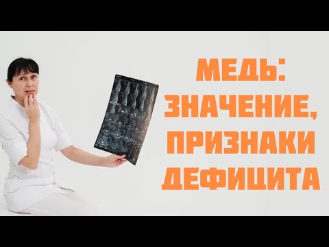 Видео: Медь: значение для организма, признаки дефицита Доктор Лисенкова