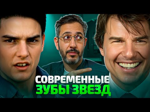 Видео: Как сейчас делают зубы звезды и сколько это стоит. Что изменилось?
