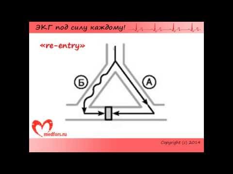 Видео: Урок 5. Видеокурс "ЭКГ под силу каждому".