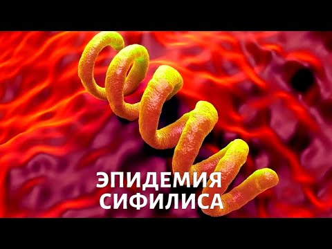 Видео: Опасный СИФИЛИС: симптомы, диагностика, лечение