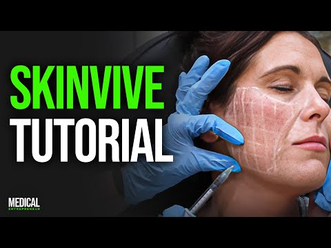 Видео: Skinvive: НОВЫЙ метод лечения стеклянной кожи | Полная демонстрация процедуры