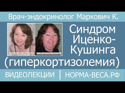 Видео: Синдром Иценко-Кушинга (гиперкортизолемия)