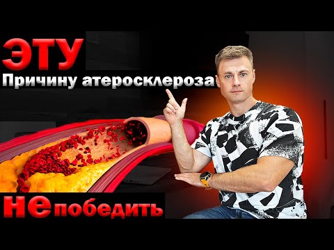 Видео: ЭТУ причину атеросклероза НЕ победить...