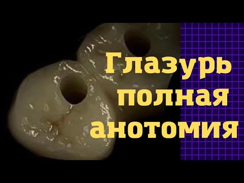 Видео: Полная анотомия. Диоксид циркония. Покраска