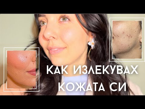 Видео: АКНЕ 101 ★ ПОРИ . ПЪПКИ . БЕЛЕЗИ