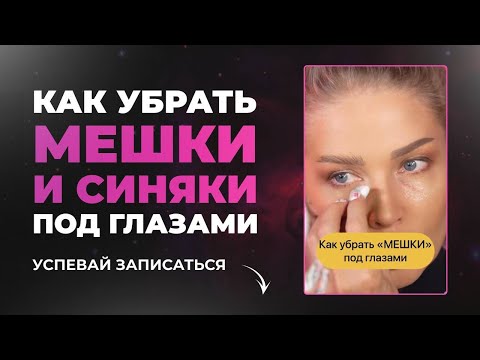 Видео: КАК ИЗБАВИТЬСЯ ОТ МЕШКОВ ПОД ГЛАЗАМИ | ЭЛЛИН СВЯТИМОВА