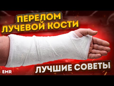 Видео: Перелом лучевой кости. ЛФК и ЛУЧШИЕ СОВЕТЫ для восстановления