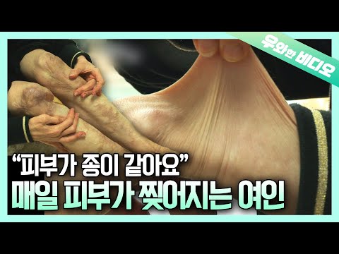 Видео: Неспособность регенерировать в течение 40 лет, и ее секрет раскрыт