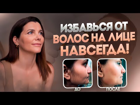 Видео: ВОЛОССЫ НА ЛИЦЕ? Не проблема! Есть решение, как избавиться ЛЕГКО!