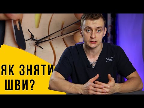 Видео: Як зняти хірургічні шви?