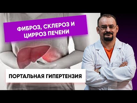 Видео: Фиброз, склероз и цирроз печени.  Портальная гипертензия.
