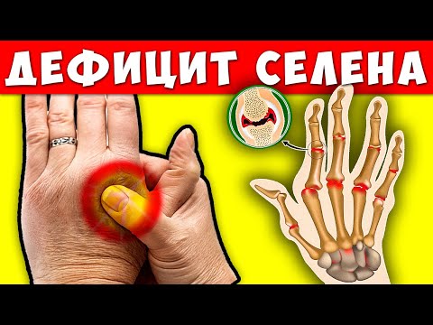 Видео: 5 Тревожных Сигналов Дефицита Селена в организме! Чем Восстановить недостаток Селена