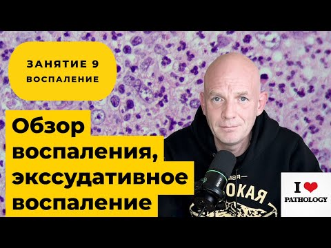 Видео: Общее понятие о воспалении. Экссудативное воспаление - краткий обзор занятия №9
