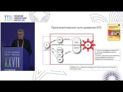 Видео: Морфологические аспекты анапластического рака щитовидной железы