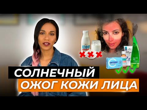 Видео: Солнечный ожог кожи лица: как быть и что делать? Алгоритм действий при ожоге кожи лица