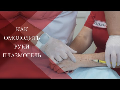 Видео: 💉ПЛАЗМОГЕЛЬ КИСТЕЙ РУК |БЕЗОПАСНЫЙ и ЭФФЕКТИВНЫЙ метод в контурной пластике