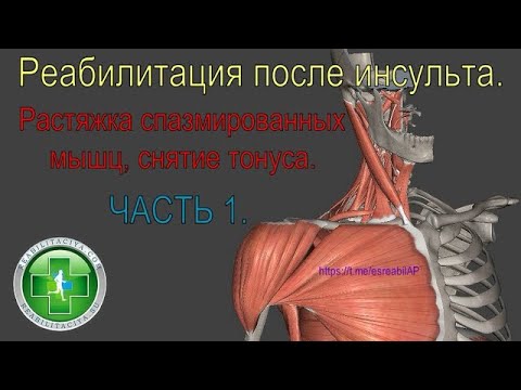 Видео: Растяжка спазмированных мышц после инсульта. Уменьшение спастики, подготовка к активным движениям.