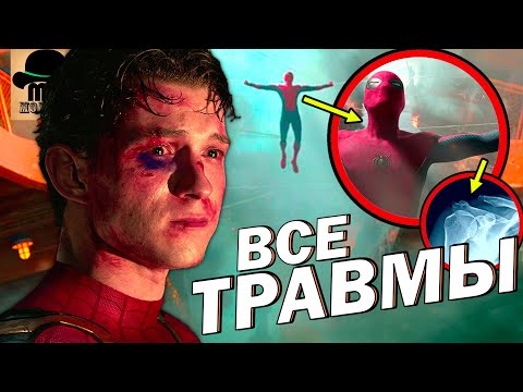 Видео: 🔴 ВСЕ ТРАВМЫ ЧЕЛОВЕКА-ПАУКА! Какой УРОН смог пережить Питер Паркер (Том Холланд)?