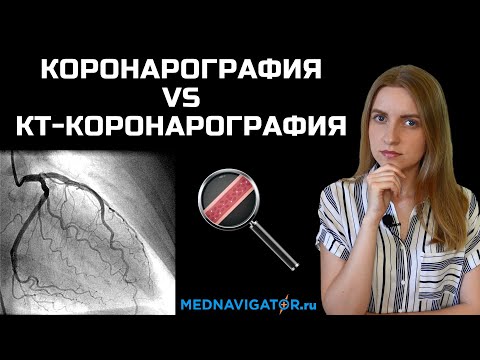 Видео: Коронарография против КТ-коронарографии (МСКТ) сосудов сердца | Mednavigator.ru