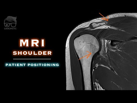 Видео: МРТ – ПЛЕЧО – ПОЛОЖЕНИЕ ПАЦИЕНТА