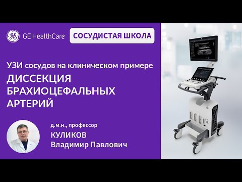 Видео: Сосудистая школа GE Healthcare. Диссекция брахиоцефальных артерий. Сессия №16