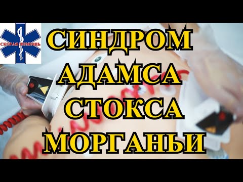 Видео: Синдром Морганьи - Адамса - Стокса