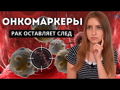 Видео: Роль ОНКОМАРКЕРОВ в диагностике и лечении РАКА | Mednavigator.ru