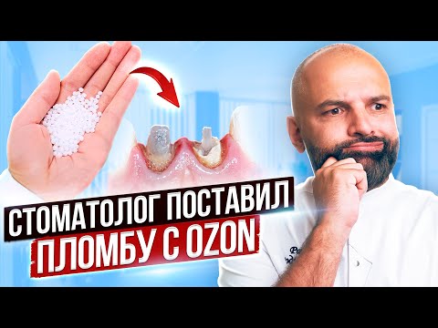 Видео: Самый популярный товар на Ozon Зубная пломба - виниры. Стоматолог проверил пломбу - виниры с ОЗОН