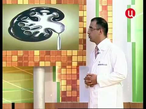 Видео: ТВЦ - Клиника Союз - гидронефроз - Диланян О.Э.