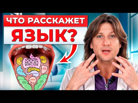 Видео: Язык КРИЧИТ о болезнях! / Как диагностировать болезни по языку?