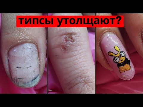 Видео: ПЕРЕНАРАЩИВАНИЕ // ДИЗАЙН НА ВСЕХ НОГТЯХ