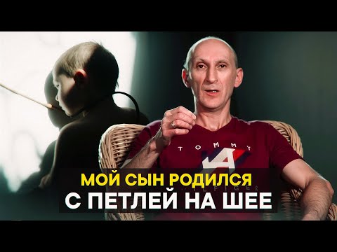Видео: Мой сын родился с петлей на шее
