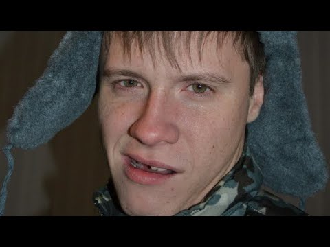 Видео: Во сколько обойдутся новые Зубы в Минске?Машину разбили,работы НЕТ!!!