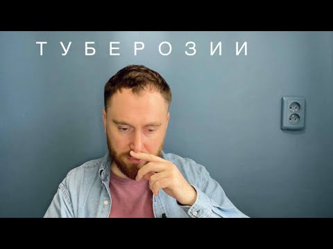 Видео: Аккорд «П». Туберозные слепые затесты от Лены