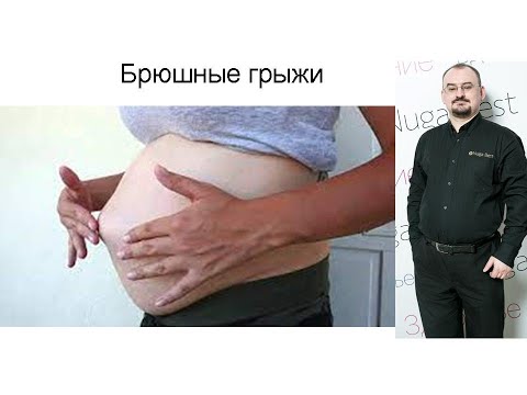 Видео: Брюшные грыжи