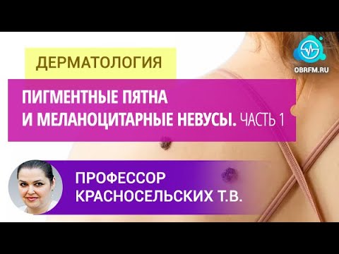Видео: Профессор Красносельских Т.В.: Пигментные пятна и меланоцитарные невусы. Часть 1