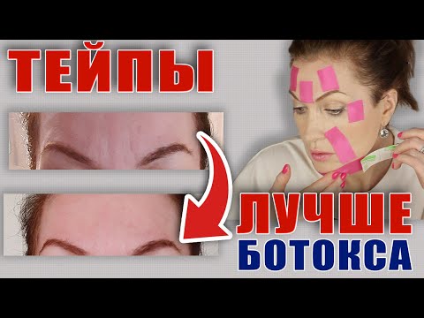 Видео: Тейпы вместо ботокса! Фото до и после! Супер эффект!