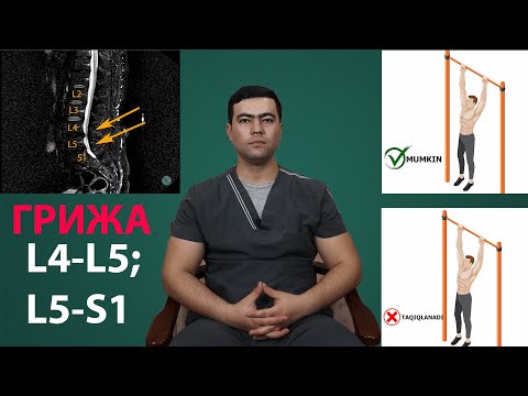 Видео: БЕЛ КИСМИДА L4-L5, L5-S1 СОХАСИДА КУП УЧРОВЧИ ГРИЖА , ДАВОЛАШ УСУЛЛАРИ, МАН ЭТИЛГАН МАШКЛАР