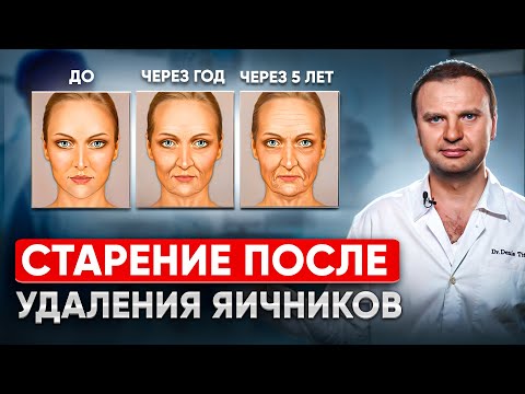Видео: Жизнь без яичников. Удаления яичников, как быстро наступает старение, гормональная терапия.