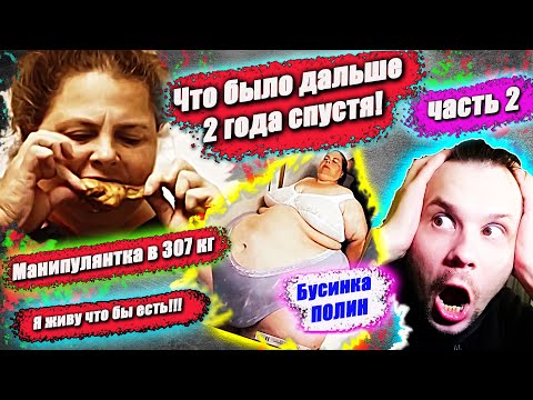 Видео: Я вешу 300 кг! ЧТО БЫЛО ДАЛЬШЕ! История Полин ч.2! ▶ СЕЗОН 3