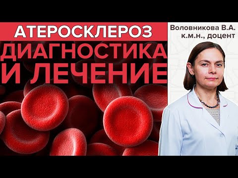 Видео: АТЕРОСКЛЕРОЗ | Диагностика и лечение атеросклероза